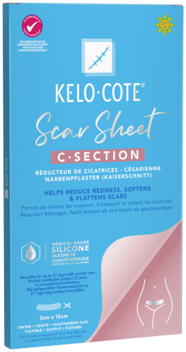 Kelo Cote Curativo para redu&ccedil;&atilde;o de cicatriz de ces&aacute;rea, 15 cm x 3 cm